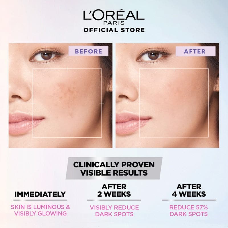 Loreal paris Glycolic Bright Instant Glowing Serum 30ml | 1% Glycolic Acid Anti-Dark Spot & Brightening Face Serum - 2